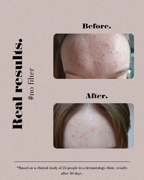 Juvy Skin Overachiever Peptide Peel Pads