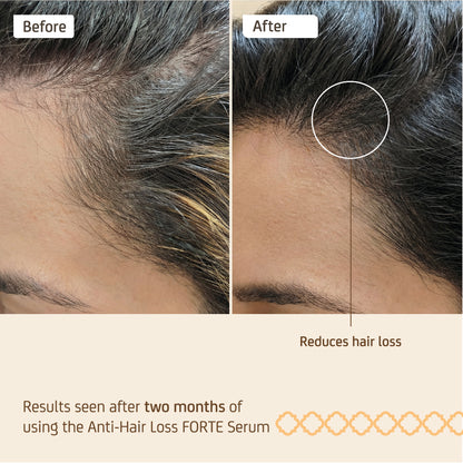 Nuggela & Sulé Anti-Hair Loss Serum Forte - 70 ml